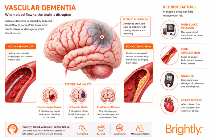 Dementia-Blog-IMG- 3