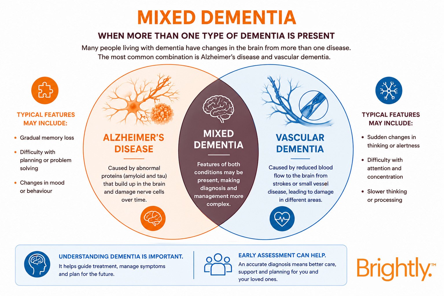Dementia-Blog-IMG- 4