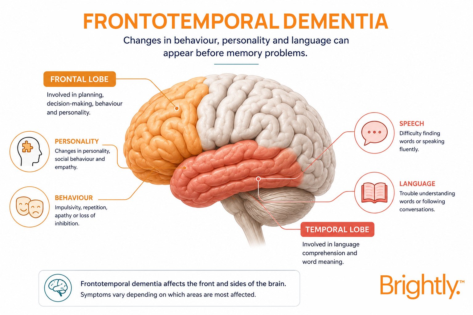Dementia-Blog-IMG- 5