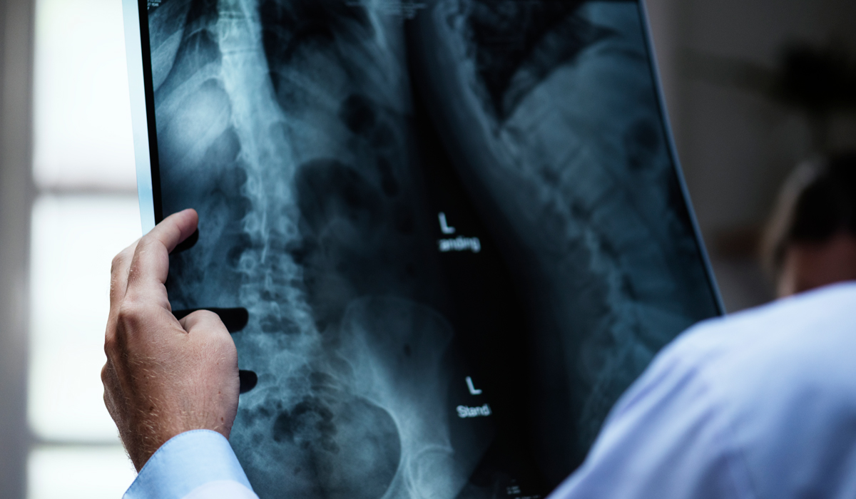 Brightly-Biomarkers-doctor-with-patient-s-x-ray-film