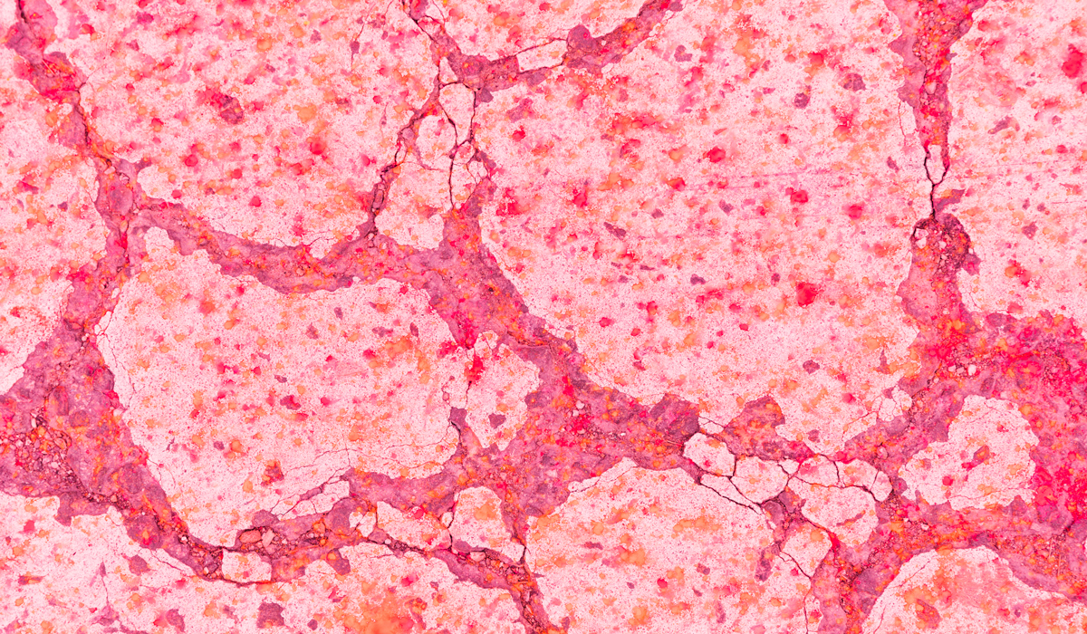 Brightly-Biomarkers-white-cracked-surface-pink-paint